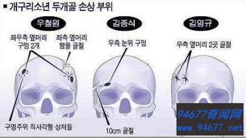 青蛙少年失踪案